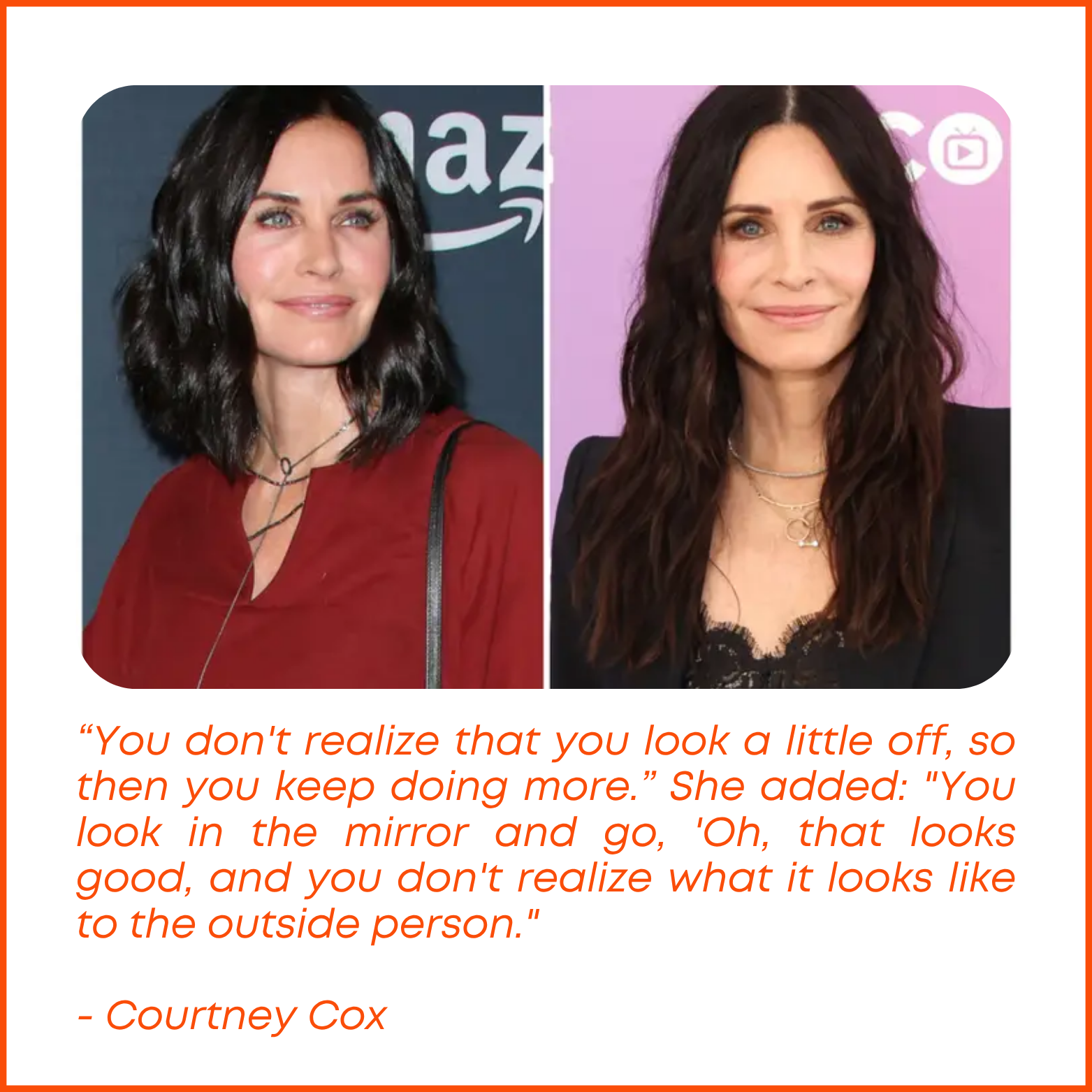 Why Celebs Are Ditching Fillers and Turning to Natural Face Workouts
